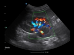 1_Apogee-2100-V-Clinical-Image-1