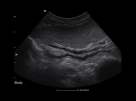 2_Apogee-2100-V-Clinical-Image-2