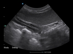 4_Apogee-2100-V-Clinical-Image-4