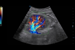 Clinical_Image_2