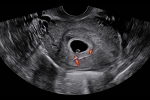 Clinical_Image_4