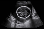 Clinical_Image_5