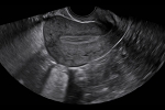 Clinical_Image_6