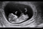 Clinical_Image_7