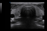 Clinical_Image_8