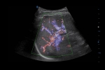 5-210Q3153550G3