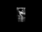 CTS-800_Clin2