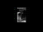 CTS-800_Clin3