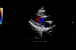 V75_Clinical1
