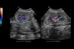 V75_Clinical4