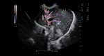C5_Clinical_Image1