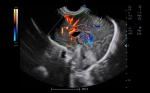 C5_Clinical_Image2