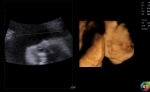 C5_Clinical_Image3
