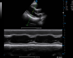 C5_Clinical_Image4