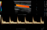 C5_Clinical_Image5