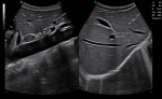 C5_Clinical_Image6
