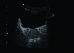 A2100-Clinical4