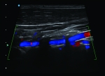 A2300-Clinical2