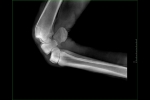 X-ray_image_3