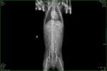 X-ray_image_4