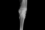 X-ray_image_5